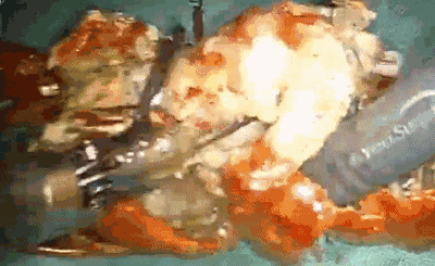 ��Ȧ(�й���)�������ǲ�!
